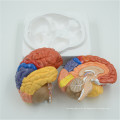 Impresión personalizada anatomía cerebral personalizada